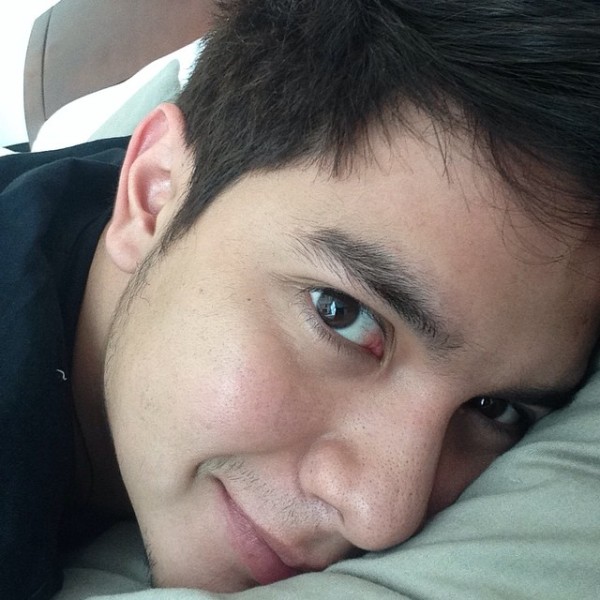 Alden Richards