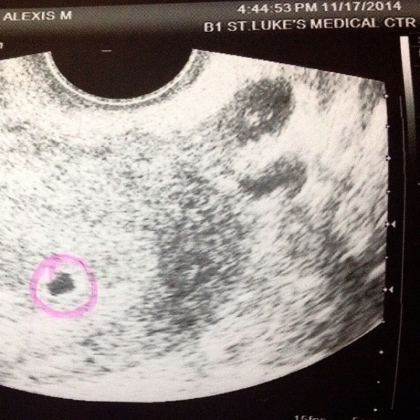 Jennica and Alwyn's baby