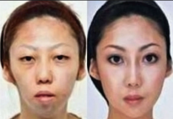 Hong Kong women plastic surgery