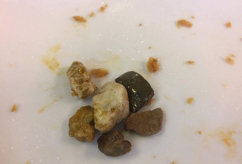 Some of the rocks found in the kilo of sea snails.