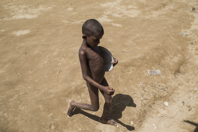 A Rohingya Muslim refugee carries his plate to receive food at a distribution area at Balukhali refugee camp near the town of Gumdhum in Cox’s Bazar on OCtober 1, 2017.
The UN says more than 14,100 children are suffering from life-threatening malnutrition in wretched camps where half a million mainly Rohingya refugees depend entirely on overstretched charities for food to survive. / AFP PHOTO / FRED DUFOUR /