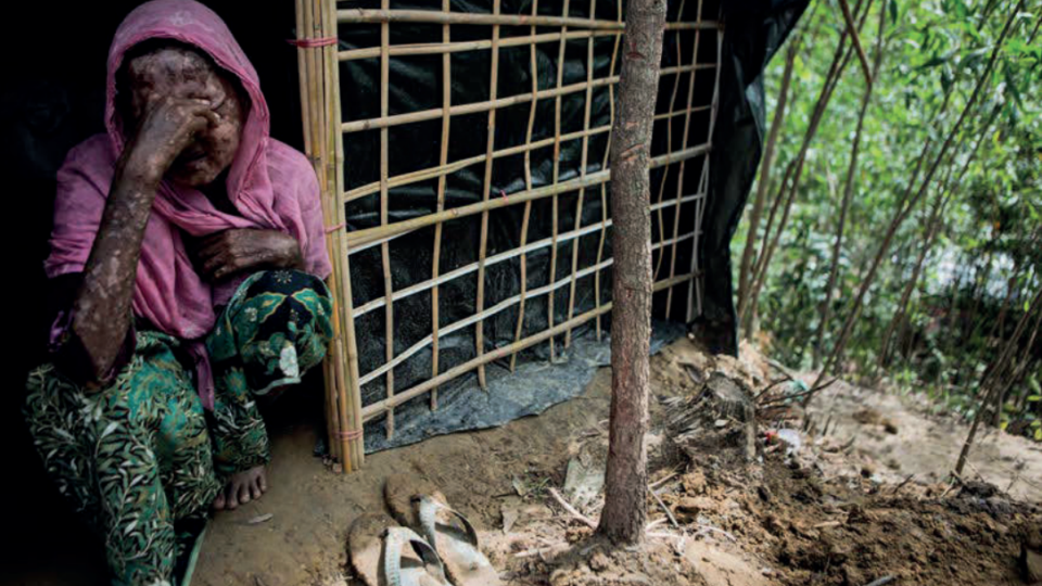 Shara Jahan, 40, sits for a portrait near her shelter in Kutupalong Refugee Camp, 29 September 2017. She suffered serious burn wounds when the Myanmar military surrounded and torched her village of Chut Pyin. Her roof caught fire with her still inside. © Andrew Stanbridge / Amnesty International