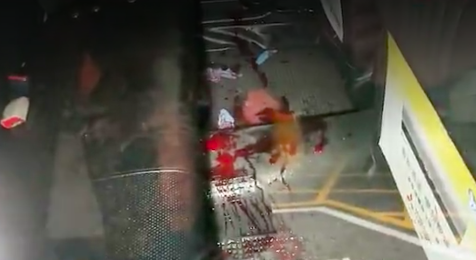 A 36-year-old man surnamed Che was taken to a hospital by a taxi driver following an attack in Wan Chai. This picture, from Apple Daily footage, shows inside the cab hailed by the injured man.