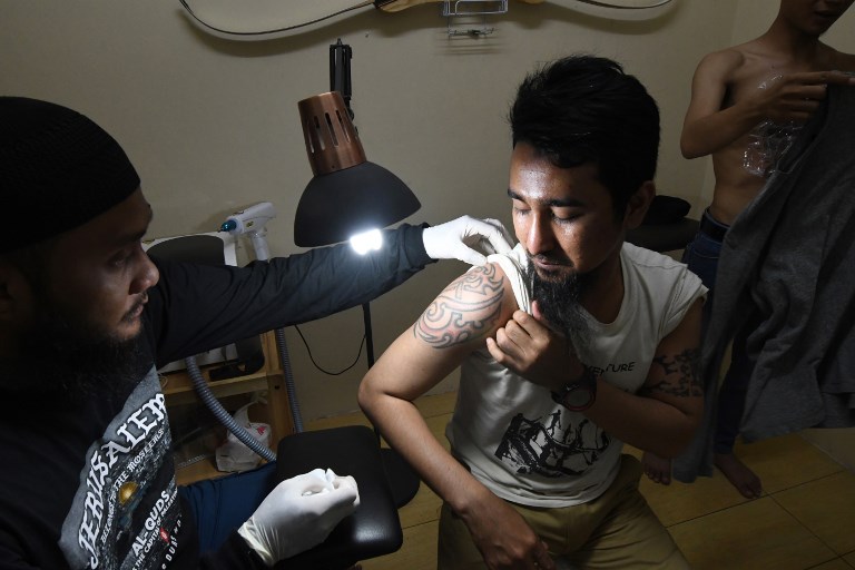This picture taken on April 18, 2018 shows tattoo remover Sandi Widodo (L) removing a tattoo of a Muslim man at the Hijrah Tattoo Removal clinic in Jakarta.  AFP PHOTO / GOH CHAI HIN 