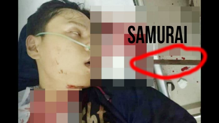 A katana pierced through a student’s cheek during a brawl in Indonesia. Photo: Facebook