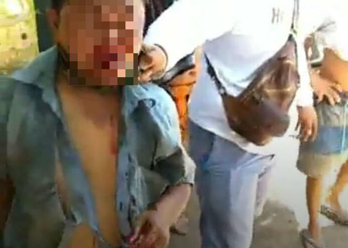 A man who allegedly attempted to kidnap a six-year-old girl in Karangasem on Sunday was beaten by a mob before being detained by police. Photo via Project Karma/Facebook