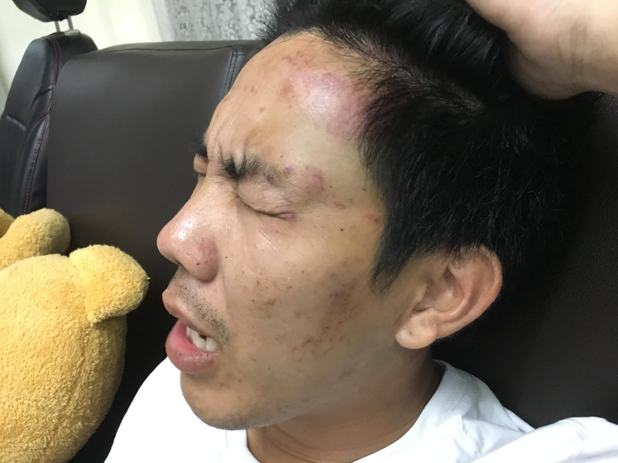 Another teacher death with a head injury. Photo: Facebook/ Red Skull, helping victims of crime