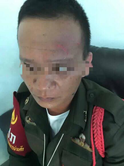 An injured security guard. Photo: Facebook/ Red Skull, helping victims of crime