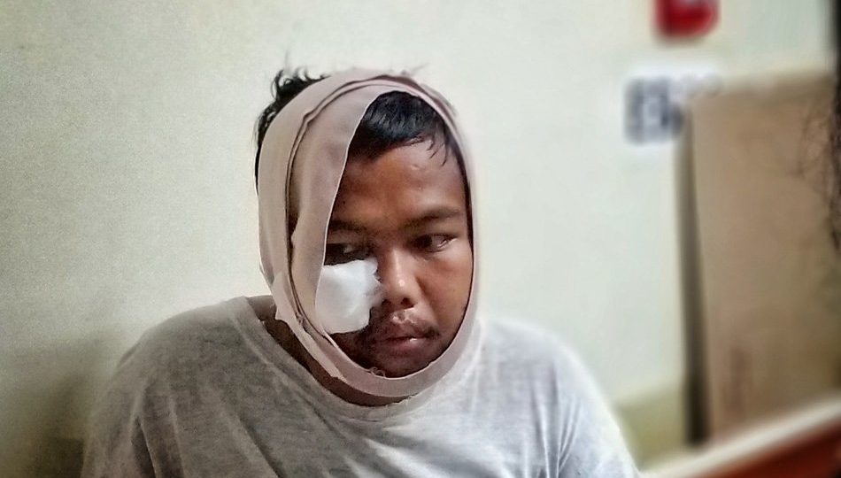 Roger Herrero after he was allegedly abducted and shot by the police. Photo: Vincent Go/ABS-CBN News