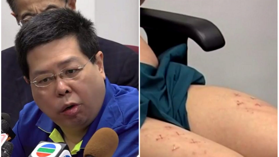 Lam (L) told reporters he had been beaten and interrogated by mainland Chinese agents. Screenshots: Apple Daily/Now TV via Facebook
