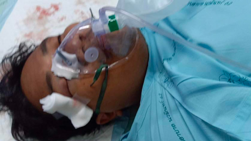 Pro-democracy campaigner Sirawith “Ja New” Seritiwat is treated for a broken eye socket and nose. Photo: Bow Nuttaa Mahattana/ Facebook