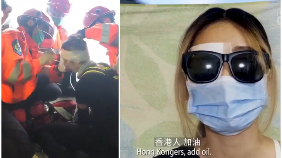 A woman identifying herself as the protester shot in the eye with a suspected bean bag round at a protest earlier this month (left) issued a video statement today slamming the government (right). Screengrabs via Facebook.