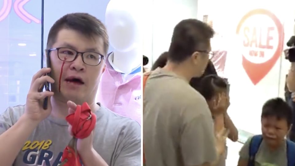 (Left) A 40-year-old man surnamed Lee with a cut under his eye after getting involved in a scuffle with pro-democracy supporters at a mall in Kowloon Bay. Lee started singing the Chinese National anthem during a flash sing-along at the mall. Screengrabs via Apple Daily video.