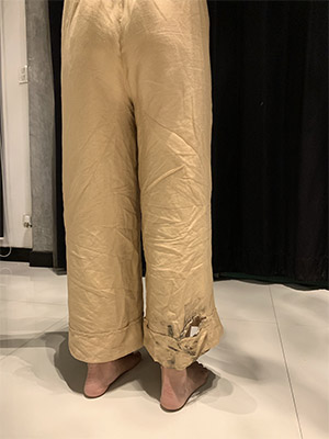 The scars Pimpaporn’s pants will forever bear. Photo: Pimpatty / Twitter