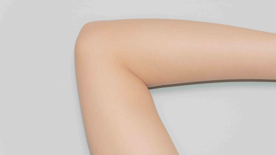 File photo of a person’s elbow. Image: 莎莉 彭