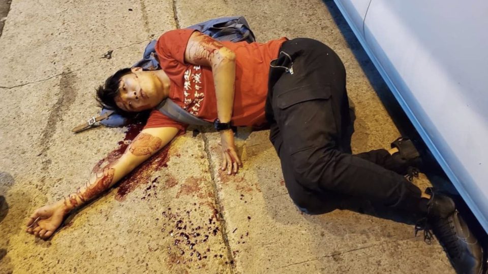 Civil Human Rights Front convenor Jimmy Sham was attacked this evening in Mong Kok by four men. Photo via Telegram.