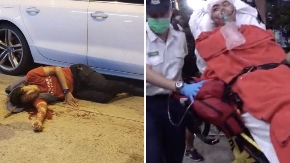 Jimmy Sham was taken to hospital after being attacked by at least four masked men in Kowloon last night. Photos and screengrabs via Telegram and Apple Daily video.