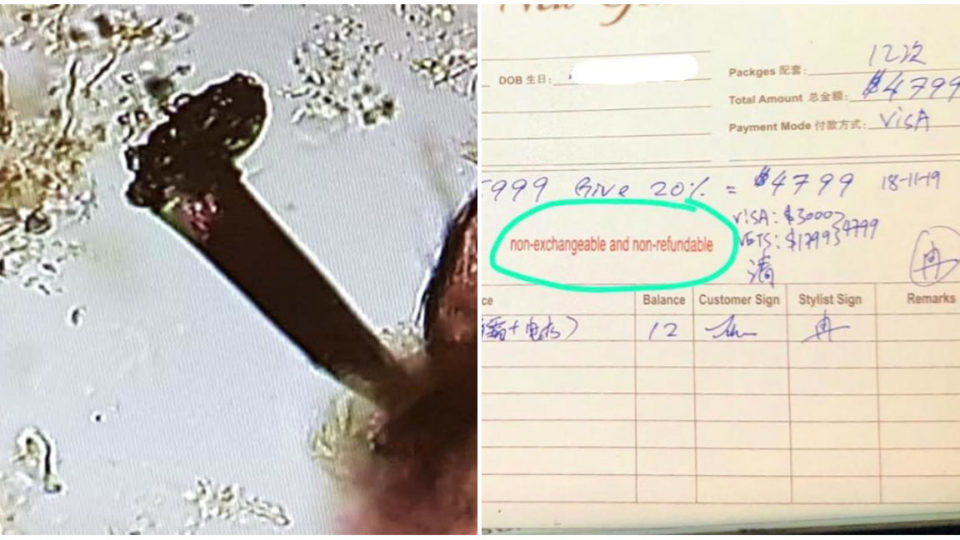 At left, image of alleged worm on scalp. At right, the S$4,799 receipt. Photos: Fiona Han/Facebook