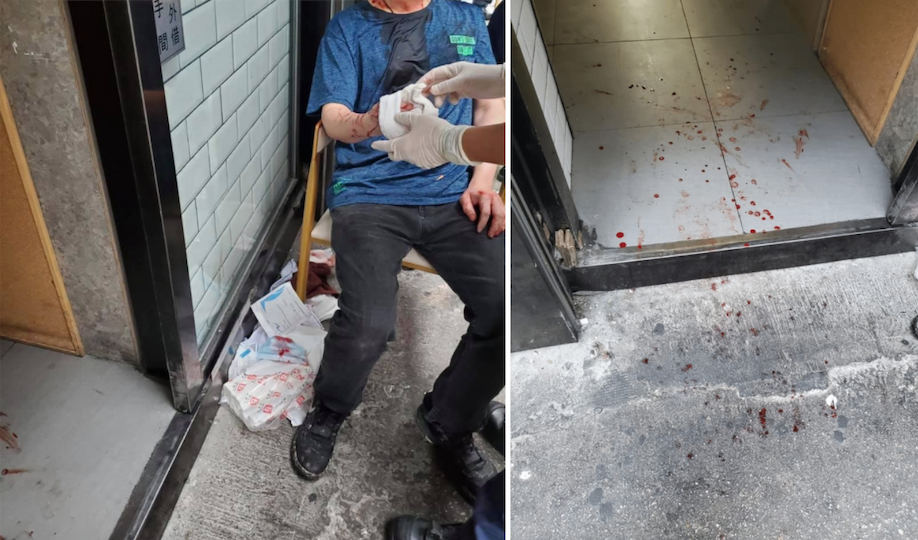 The bloody aftermath of the attack outside Lung Mun Cafe on July 6, 2020. Photos via Facebook/龍門冰室/瓏門冰室