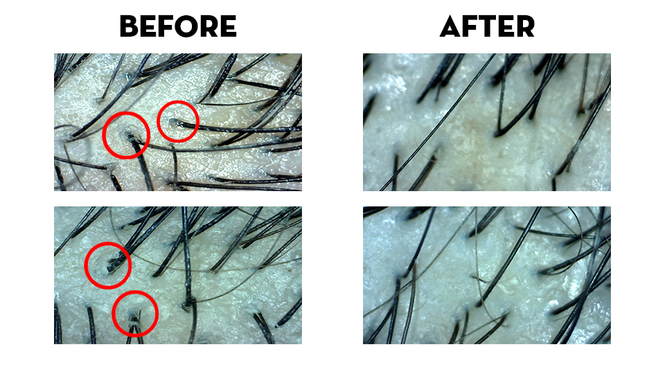 Guess you could say I got out of quite the hairy situation. Photo: TK Trichokare