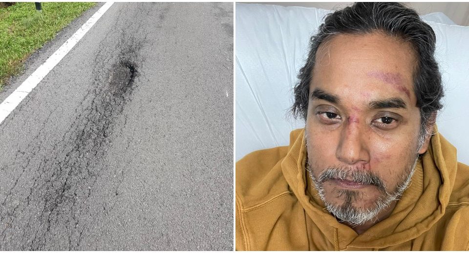 Pothole along Jalan Kampung Sri Cheeding, at left, and a bruised Khairy Jamaluddin, at right. Photos: Khairy Jamaluddin/Twitter