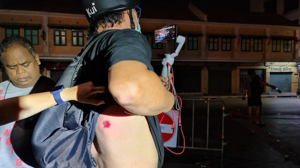 Prachatai reporter Sarayut Tangprasert shows where he was shot with a rubber bullet at Saturday’s protest. Photo: Prachatai
