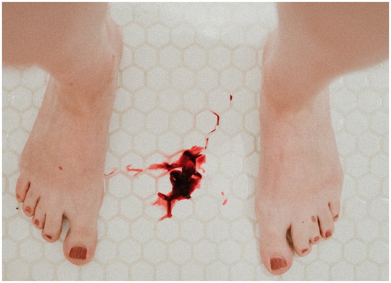 File image of blood in between a person’s legs. Photo: Monika Kozub