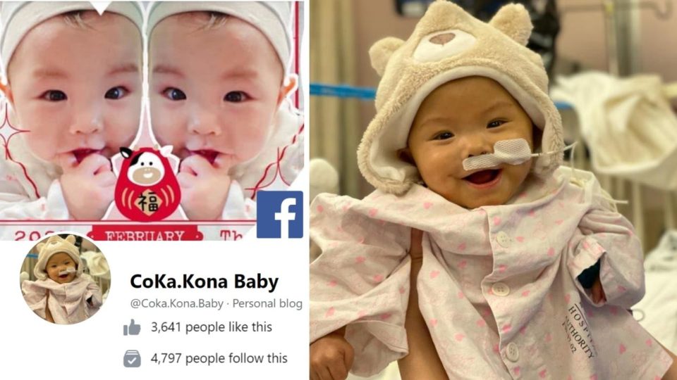 The 1-year-old twin girl was diagnosed with a life-threatening intestinal disease. Photos: Facebook/CoKa.KonaBaby