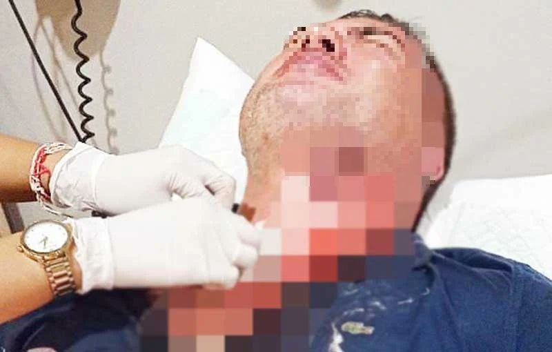 The victim was immediately taken to a local hospital for treatment. Photo: Istimewa 