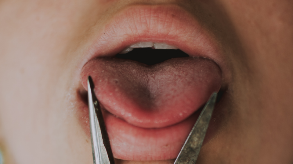 A pair of scissors near a person’s tongue. Photo: Unsplash
