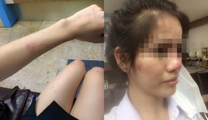 The victim, Rawisara Phenphichijit, shared details about the horrific attack on Facebook.