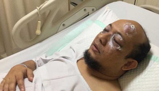 Photo of KPK senior investigator Novel Baswedan in the hospital after his acid attack on April 11.